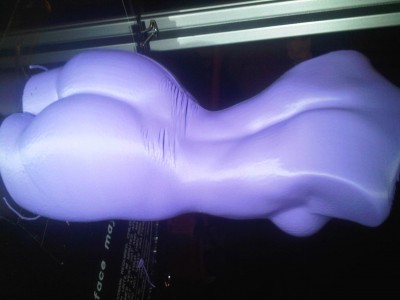 Look even in plastic women get cellulite